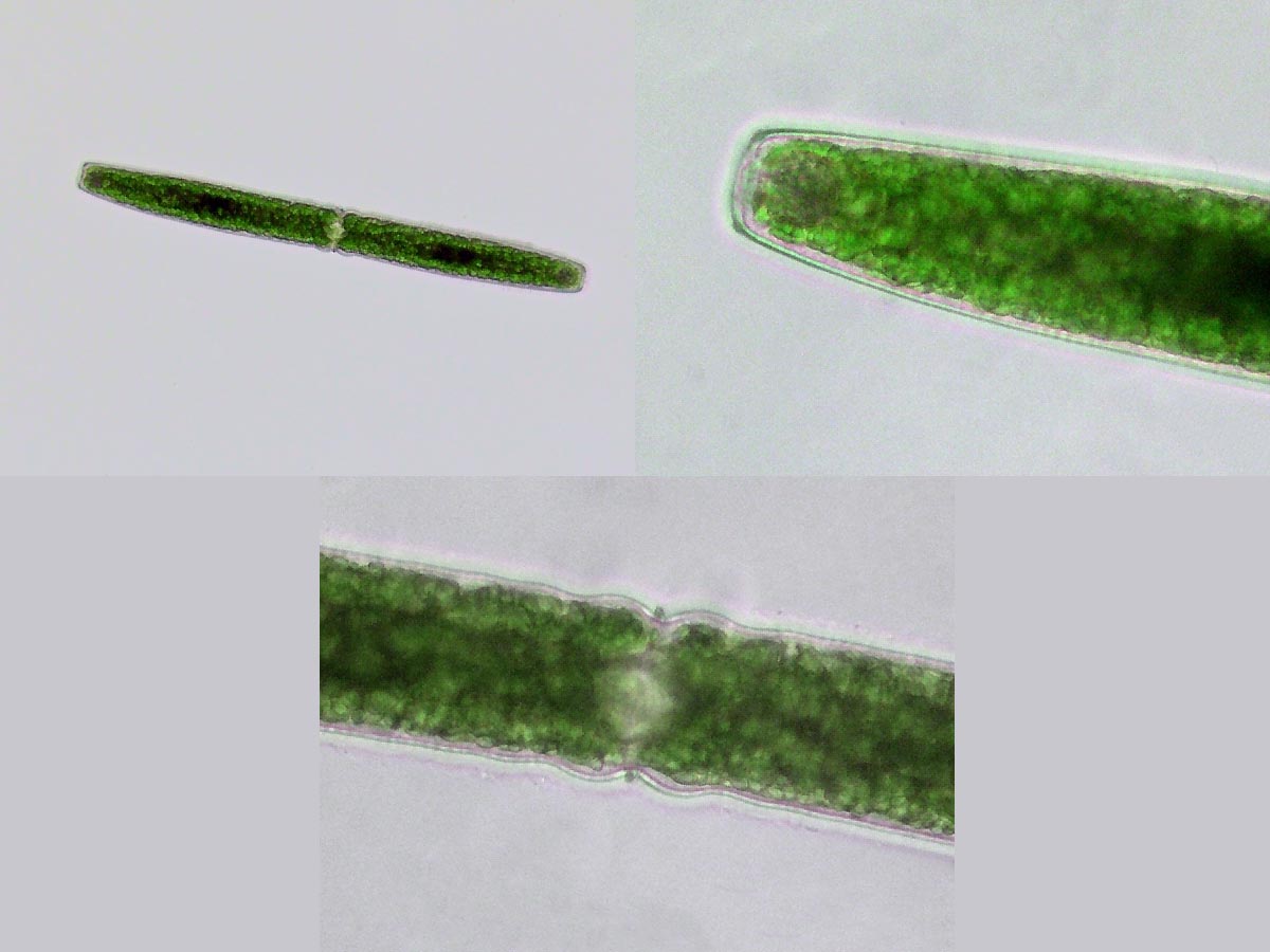 Pleurotaenium sp